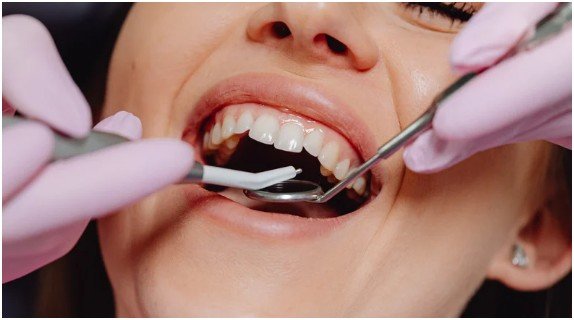 Immediate Changes: The First Few Days