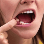 The Cost of Ignoring a Missing Tooth Why You Shouldn't Wait to Replace It
