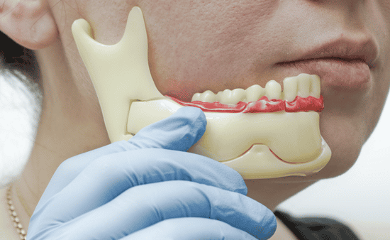 The Rapid Decline of Jawbone Density